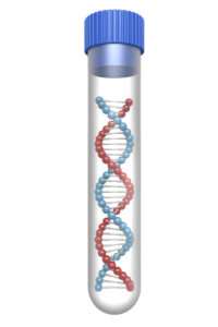 Poziom kwasu moczowego